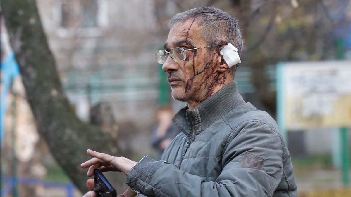 Un ciudadano ucraniano con heridas graves tras el ataque masivo con drones por parte de Rusia a Kiev, dañando infraestructuras. 