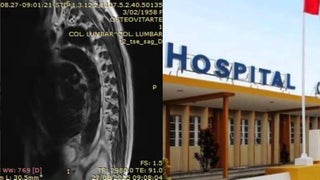 Mujer con insuficiencia renal consiguió centro de diálisis en San Martín de Porres