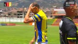 Ante la sorpresa de todos: Hernán Barcos abandonó el Sport Huancayo vs FC Cajamarca por lesión [VIDEO]