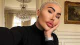 Murió influencer que gastó miles de dólares para parecerse a Kim Kardashian