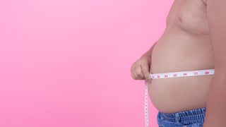Día Mundial de la obesidad: 7 de cada 10 personas tienen sobrepeso en el Perú