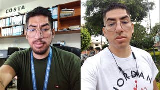 Hospital Rebagliati: paciente con tumor residual en el cerebro necesita medicamento para impedir siga creciendo