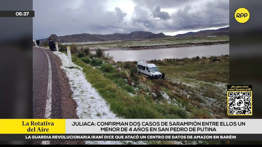 Juliaca: confirman dos casos de sarampión, entre ellos un menor de cuatro años