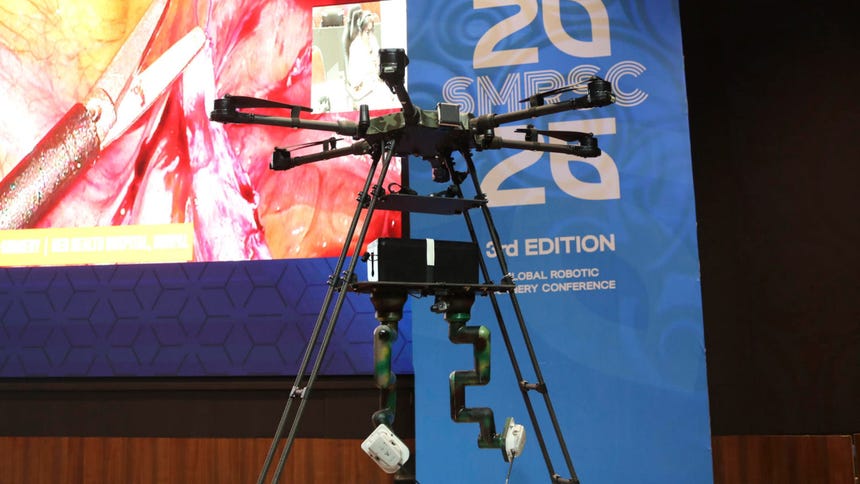 India: desarrollan dron cirujano que permite a médicos realizar operaciones a distancia en zonas de guerra y de desastre [FOTOS]