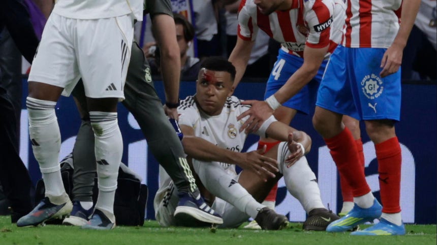 Y se viene la vuelta ante el Bayern: Kylian Mbappé no entrena en Real Madrid por un corte en la ceja