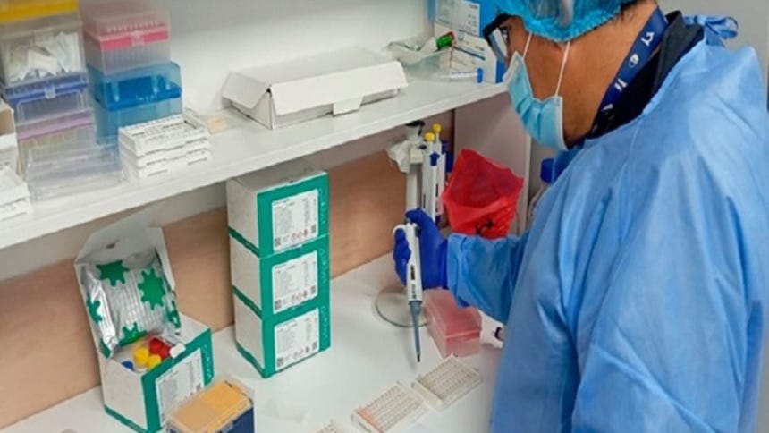 Minsa reporta cuatro casos de sarampión en Lima Metropolitana y descarta transmisión local