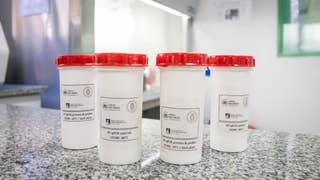 ¿Existe un nivel de riesgo en Perú por el hantavirus? Esto señaló representante del Minsa