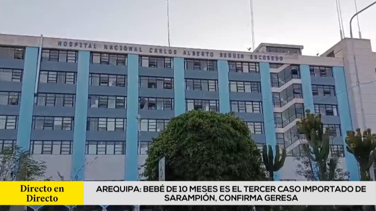 Arequipa: bebé de 10 meses es el tercer caso importado de sarampión, confirma Geresa