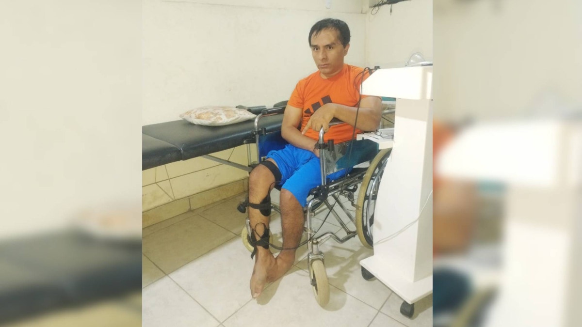 Piden compra de implementos para operar de la cabeza a padre de familia en el Hospital Dos de Mayo
