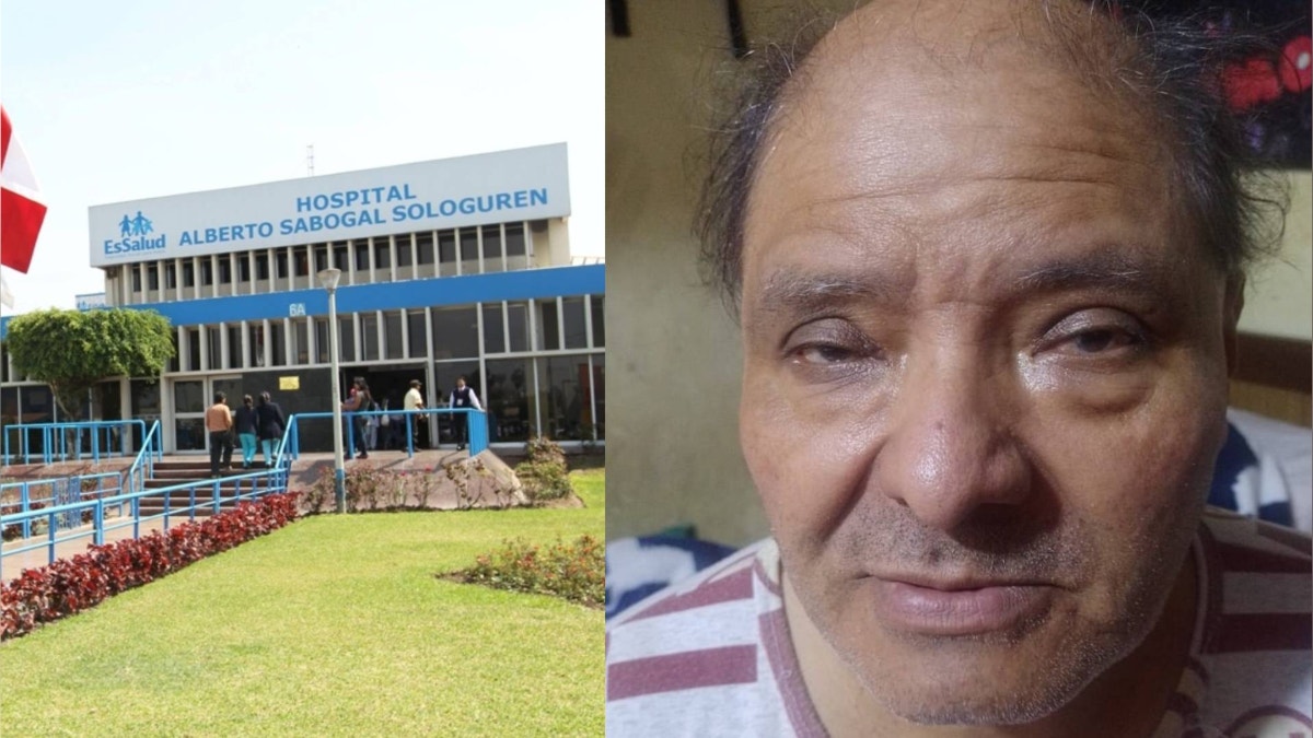 Callao: adulto mayor espera examen desde el año pasado para operarse de cataratas en el Hospital Sabogal