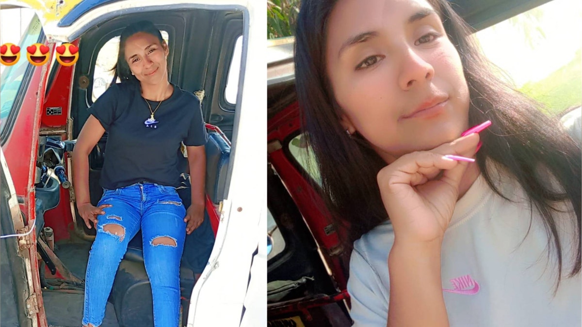 Madre de familia pide que se le retire placa de titanio que tiene hace cinco años en el fémur