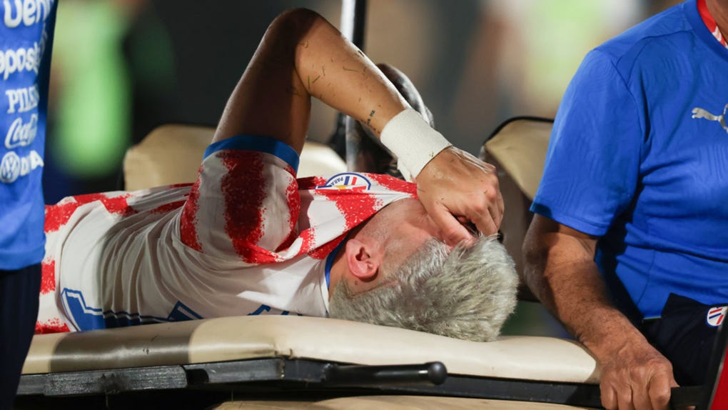 Julio Enciso de Paraguay reacciona en un partido amistoso ante Nicaragua.