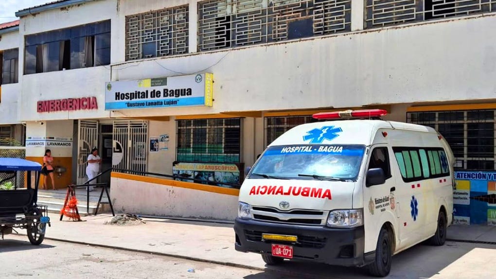 Amazonas: dos niños son hospitalizados por Leptospirosis en Bagua, uno de ellos complicado con dengue