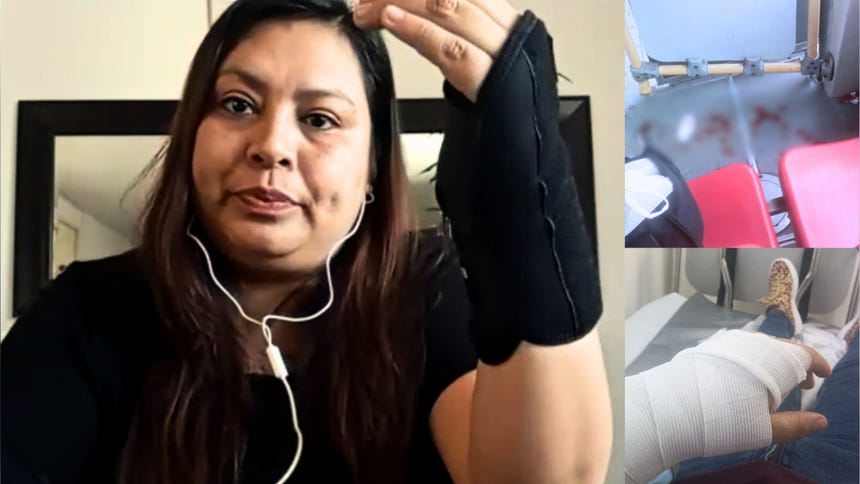Rosalyn Pinedo tiene descanso médico hasta el 3 de julio y aún no puede retornar a sus actividades cotidianas.