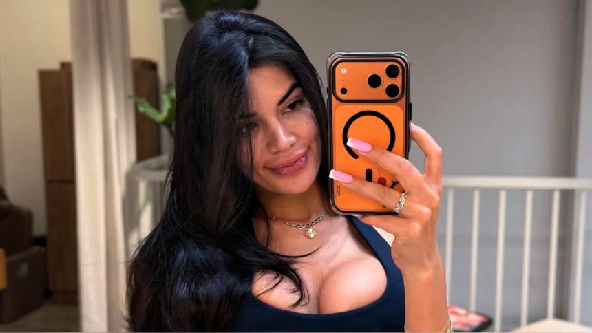 Samantha Batallanos asegura que ya sabía del romance de Luis Felipe Zapata con Suheyn Cipriani.