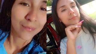 Hospital de Emergencias Villa El Salvador retirará placa de titanio a mujer tras cinco años de reiterados pedidos