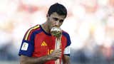 Rodri, balón de oro del Mundial 2026, fue sometido a cirugía en la espalda