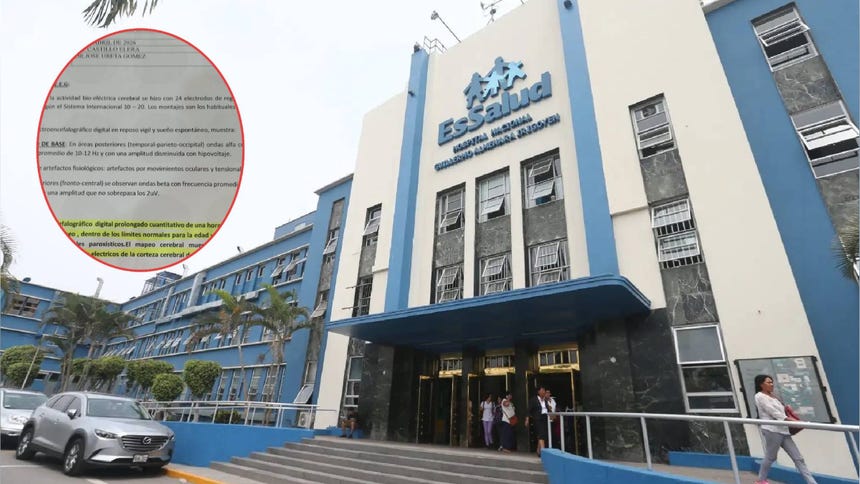Paciente con tumor en el cerebro será operado en el hospital Almenara