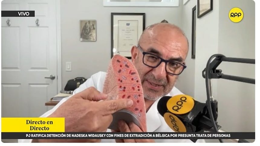 Dr. Elmer Huerta muestra la zona del pulmón que se le ha extirpado al papa León XIV. 