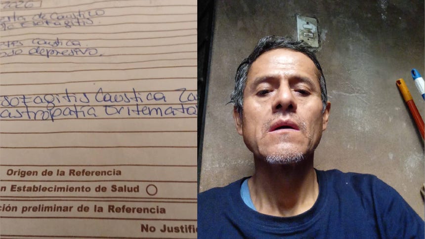 Paciente pide ayuda para conseguir cita en gastroenterología en el Hospital San Juan de Lurigancho