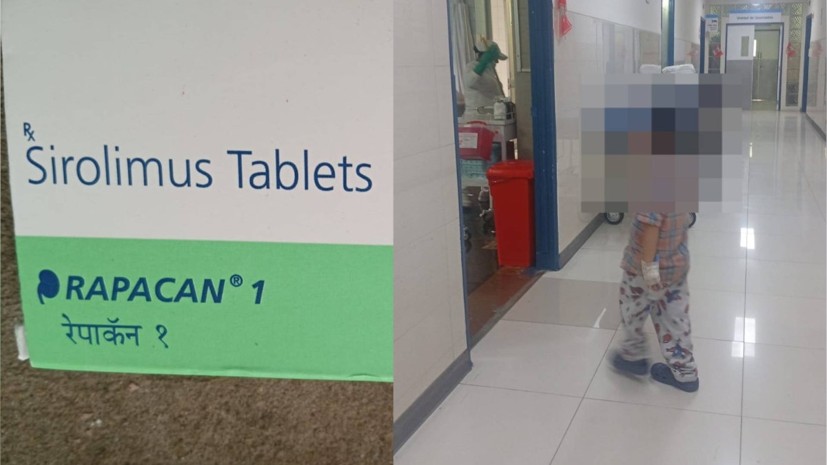 EsSalud: madre reitera pedido de compra de pastillas para menor con tumor en el ojo izquierdo