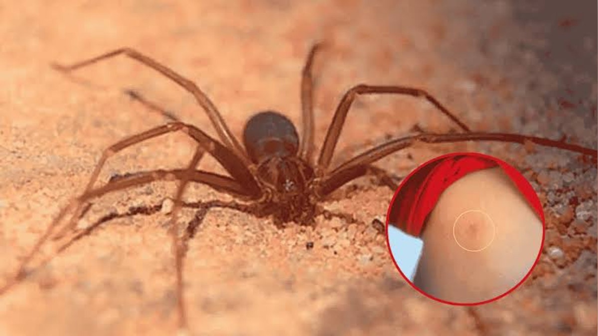 Perú produce antídoto contra mordedura de la araña casera: ¿cómo se elabora?